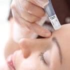 Package of 3 Microneedle at Skin Haven By Lindsey in NJ, NJ